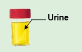 Urine exosome purification