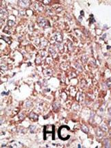 IHC-P - LYVE1 (XLKD1) Antibody (C-term) AP2015b