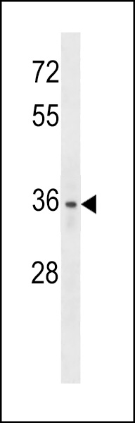 WB - LYVE1 (XLKD1) Antibody (C-term) AP2015b