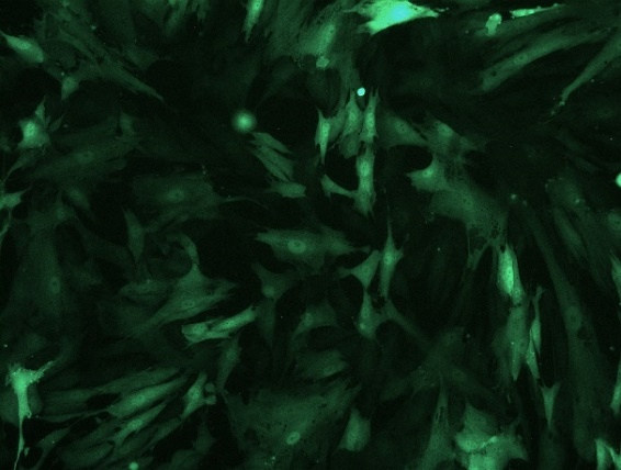 Rabbit Bone Marrow Mesenchymal Stem Cells With GFP