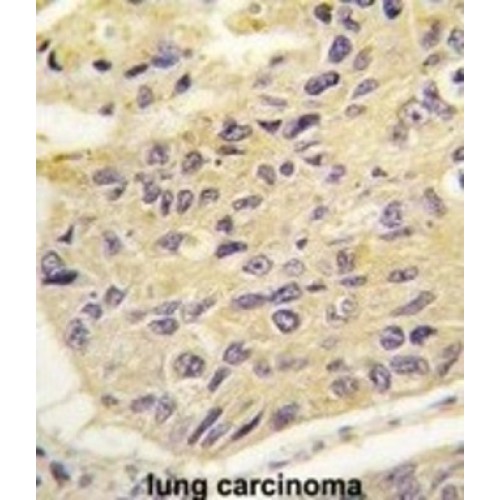 Frequently Rearranged In Advanced T-Cell Lymphomas 1 (FRAT1) Antibody