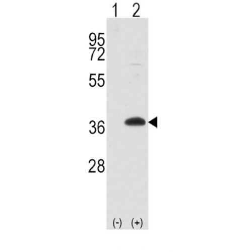 Frequently Rearranged In Advanced T-Cell Lymphomas 1 (FRAT1) Antibody