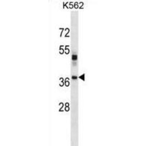 Visual System Homeobox 1 (VSX1) Antibody