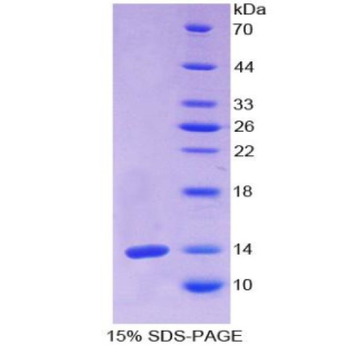 SDS-PAGE analysis of Human Olfactomedin 4 Protein.