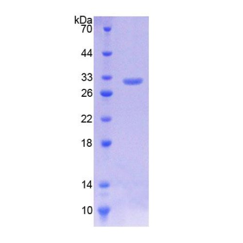 SDS-PAGE analysis of Human Kruppel Like Factor 5, Intestinal (KLF5) Protein.