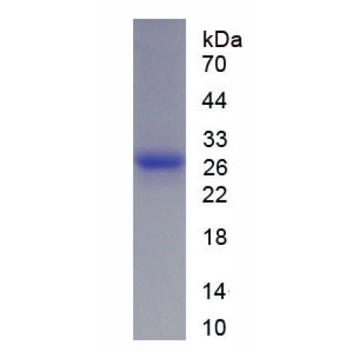 SDS-PAGE analysis of recombinant Human ENHO Protein.