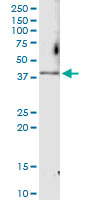 Immunoprecipitation