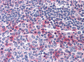 Immunohistochemistry (Formalin/PFA-fixed paraffin-embedded sections)