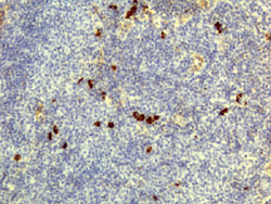 Immunohistochemistry (Formalin/PFA-fixed paraffin-embedded sections)