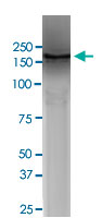 Western Blot