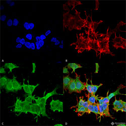 Immunocytochemistry