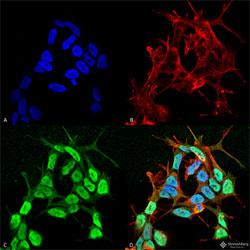 Immunocytochemistry