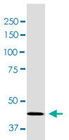 Western Blot (Tissue lysate)