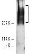 Western Blot (Cell lysate)