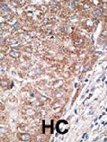 Immunohistochemistry (Formalin/PFA-fixed paraffin-embedded sections)