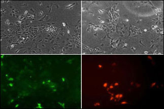 Immunofluorescence