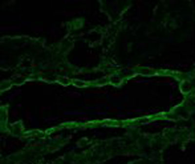 Immunofluorescence