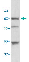 Western Blot (Tissue lysate)