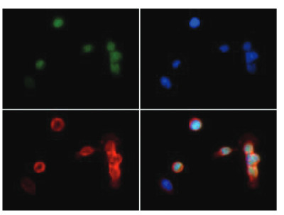 Immunofluorescence using anti-H3K18me2 | Histone H3 (dimethyl Lys18) polyclonal antibodies