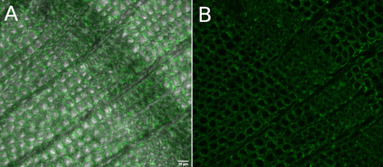 Immunofluorescence using anti-heteroxylan antibodies