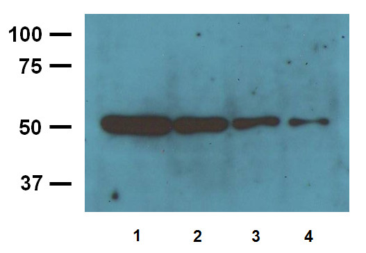 Western blot using anti-beta tubulin antibodies