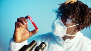 A scientist holds a vial of blood ready to be tested. Osteopontin shows potential as a biomarker to detect adverse drug reactions.