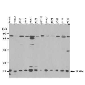 Western Blot