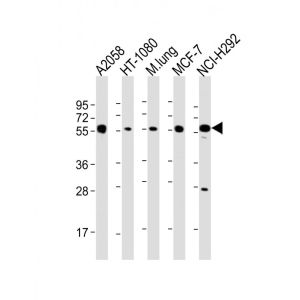 A2058, HT-1080, Mouse Lung, MCF-7, NCI-H292