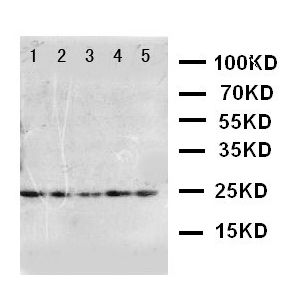 U87, Hela, A519, 293T, Hela