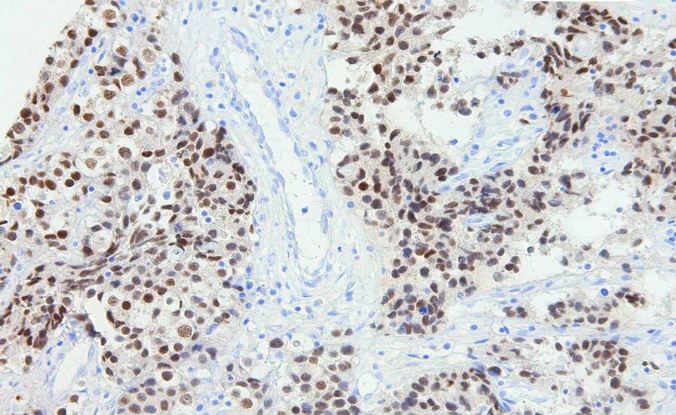 Ovary Immunohistochemistry