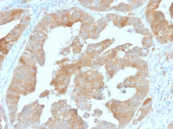 IDH1 (Isocitrate Dehydrogenase) Antibody