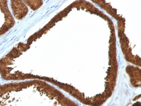 IDH1 (Isocitrate Dehydrogenase) Antibody - Image 2