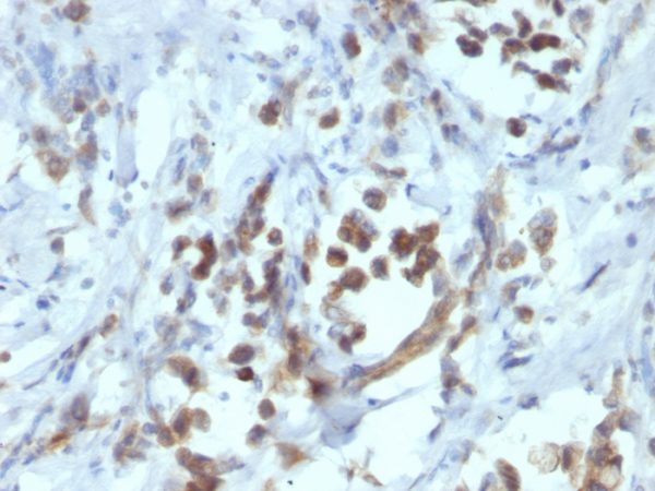 PAX6 (Stem Cell Marker) Antibody