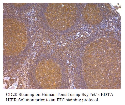 EDTA - Saline Buffer (10X Concentrate); pH 8.0