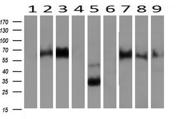 NPTN Mouse Monoclonal Antibody [Clone ID: OTI3C4]