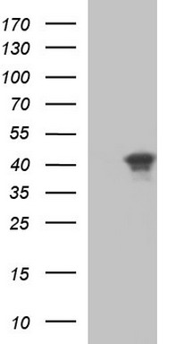 SPARC Mouse Monoclonal Antibody (Biotin conjugated) [Clone ID: OTI2B1]