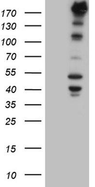 Nestin (NES) Mouse Monoclonal Antibody [Clone ID: OTI1B4]