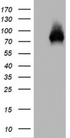 p63 (TP63) Mouse Monoclonal Antibody [Clone ID: OTI4E7]