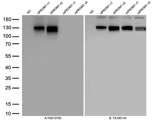 CD133 (PROM1) Mouse Monoclonal Antibody [Clone ID: OTI5G10]