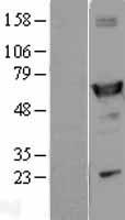 ALDH1A1 (NM_000689) Human Over-expression Lysate