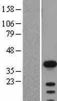 SOX2 (NM_003106) Human Over-expression Lysate