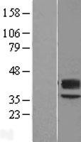 CD57 (B3GAT1) (NM_018644) Human Over-expression Lysate