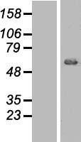 AKT1 (NM_005163) Human Over-expression Lysate