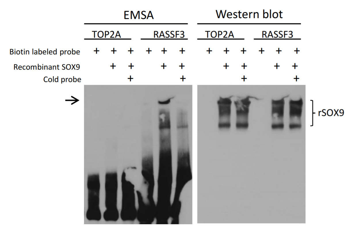 SOX9 (NM_000346) Human Recombinant Protein