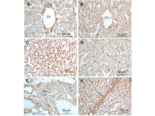 Immunohistochemistry - Anti-Collagen I