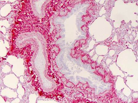 Anti-Collagen I - Immunhistochemistry