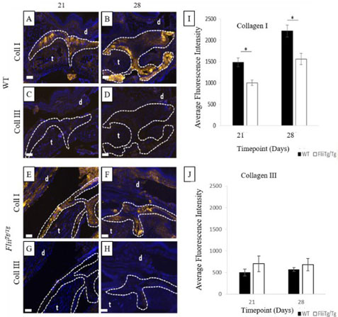 Immunohistochemistry of Anti-Collagen Type I