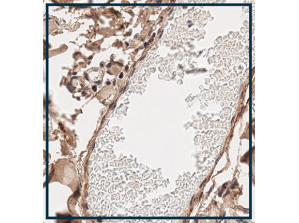 Immunohistochemistry using Rabbit Anti-Collagen Type I Antibody.