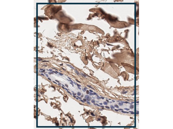 Immunohistochemistry using Rabbit Anti-Collagen Type I Antibody.