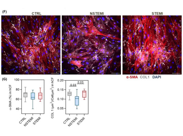 Immunofluorescence of Rabbit Anti-Collagen Type I Antibody